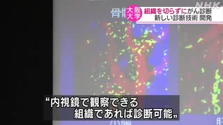 組織を切らずに がん診断