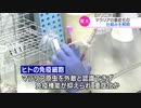 マラリアの重症化　仕組みを解明