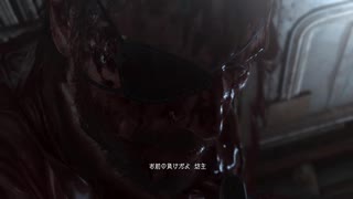 【METAL GEAR SOLID5】隠密行動苦手なうちですがMGS5やってみる！【パート１７】その５
