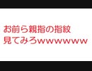 【なんJ】お前ら親指の指紋見てみろｗｗｗｗｗｗｗｗｗｗｗｗｗｗｗｗｗｗｗｗｗｗｗｗｗｗｗｗｗ@2ch.sc(5ch)2016年のスレ