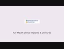 All On Four Dental Implants in North Palm Beach, FL | 561-627-5560