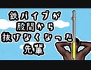 鉄パイプがチン〇から抜けなくなった先輩