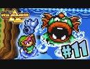 歯ガチャガチャだから、インプラントしてもらったほうがいいよ【ゼルダの伝説神々のトライフォース】#11