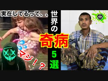 信じられない世界の【奇病】！TOP5