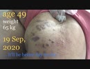 202009192210■suffered after darkskin TV/Showbiz coming(also in vogue at Tokyo after African visiting