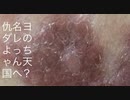 【1904年以来流行中】奇病通称「印土黒人病(欧名:The Browny Disease)」印土Brumaの形をしてます