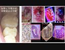 【Male Candida now on vogue(2015-)】奥歯= Satan【歯型遺伝子最強】