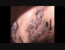 202006240744■4years&9months after 2015 Arson by dark skin&elder Jap TV/Showbiz