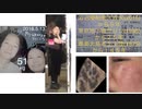 【Take shit Street@Uglyculture&ORK奥's】Memo:Herpes&Herpes zoster suffered by Jap TV/Showbiz&Dark skin