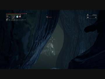 『Bloodborne』を94ミリは知ってる俺が実況プレイ【DLC】