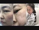 Memo: _φ(･_･;)  今月未だ白髪染めしてないw【WHITE ONLY FOREVER】it's not the blemish on my cheeksこれ全部シミそばかすではありません