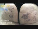 202010060152■表面の皮膚だけ剥がれています > 乾燥する季節到来 酵素系漂白剤に浸し 使い捨て台所用で擦った後の画像です