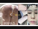 afterDarkskin&US/UK/JAP TV,Athlete/Actor/Actress/Musician/Comedian TagTERROR,25years after 1995SARIN