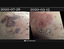 [Ad(広告)]1993年東京の大学生の間でProzac（プロザック）「個人輸入」が大流行