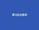川地整体治療院 パーキンソン病治療結果11