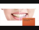 Smile Design Dental Spa : Dental Implants Mount Kisco NY