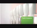 Progressive Dental : Teeth Implants in Matteson IL