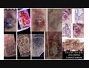 【'90s.-'00s.】【ファン数水増し】【TV芸能界主導偽造健保大量発行問題】【無許可社保患者カルテ病名改ざん】