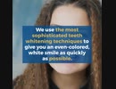 Cosmetic Dental Procedures to Transform Your Smile