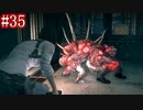 【ホラー】この素晴らしい『サイコブレイク』で絶望を！#35