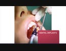 Smile Design Dental Spa Mt Kisco NY : Dentist