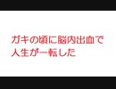 【2ch】ガキの頃に脳内出血で人生が一転した