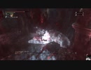 Bloodborne：初見素手縛り+α　ボス戦　[Part.47]