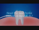 Miami Dental Group - Dental Implants in Kendall, FL