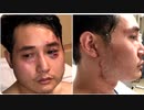 Antifaから殺害予告・ジャーナリストがアメリカ脱出・当局は動かず