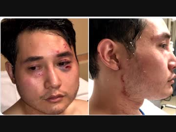 Antifaから殺害予告・ジャーナリストがアメリカ脱出・当局は動かず