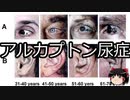 【ゆっくり朗読】ゆっくりさんと不思議な病気 その307