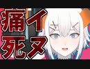 最高の撮れ高病院エピソードをすっかり忘れてたレヴィ