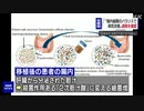 “腸内細菌改善で腸炎回復” プロセス初解明 大阪市立大など
