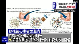 “腸内細菌改善で腸炎回復” プロセス初解明 大阪市立大など