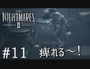 【Little Nightmares2-リトルナイトメア2-】新たなリトルナイトメアの世界【実況】#11