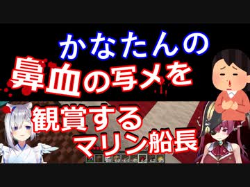 かなたんの鼻血の写メに興味を持った宝鐘マリン
