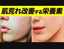 肌荒れを改善させる6つの栄養素とおすすめの食材【ビーレジェンド プロテイン】