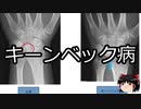 【ゆっくり朗読】ゆっくりさんと不思議な病気 その330