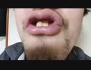ホモと見る汚いキスでアンチに攻撃してくる大物YouTubeｒ.teccune