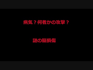 病気？何者かの攻撃？謎の脳損傷