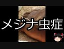 【ゆっくり朗読】ゆっくりさんと不思議な病気 その376