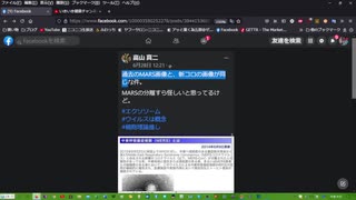 【新型コロナはデマ】国立感染症研究所のHPに掲載されている新型コロナウイルスとされている電子顕微鏡写真は捏造だったと判明!