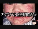 【ゆっくり朗読】ゆっくりさんと不思議な病気 その379