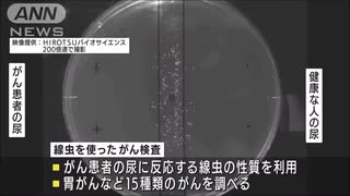 尿1滴で・・・線虫がん検査の拠点が新宿にオープン