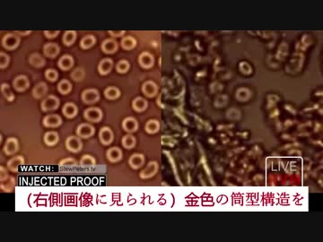 ワクチン接種者の血液に一体何が起こっているのか？！  ジェーン・ルビー医師が、顕微鏡下で見たその血液の衝撃的な映像を伝えます