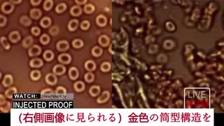 ワクチン接種者の血液に一体何が起こっているのか？！  ジェーン・ルビ...