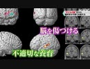 体罰や暴言で傷つく子どもの脳 回復させる方法とは？ | “子どもの脳”を守れ 脳科学が子育てを変える |