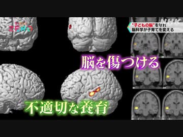 体罰や暴言で傷つく子どもの脳 回復させる方法とは？ | “子どもの脳”を守れ 脳科学が子育てを変える |