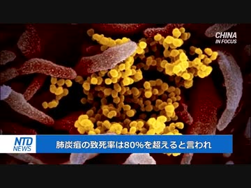 中国で炭疽病患者を１人確認・2011年以降で初
