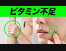 ビタミンが不足すると身体に起こるサイン【ビーレジェンド プロテイン】